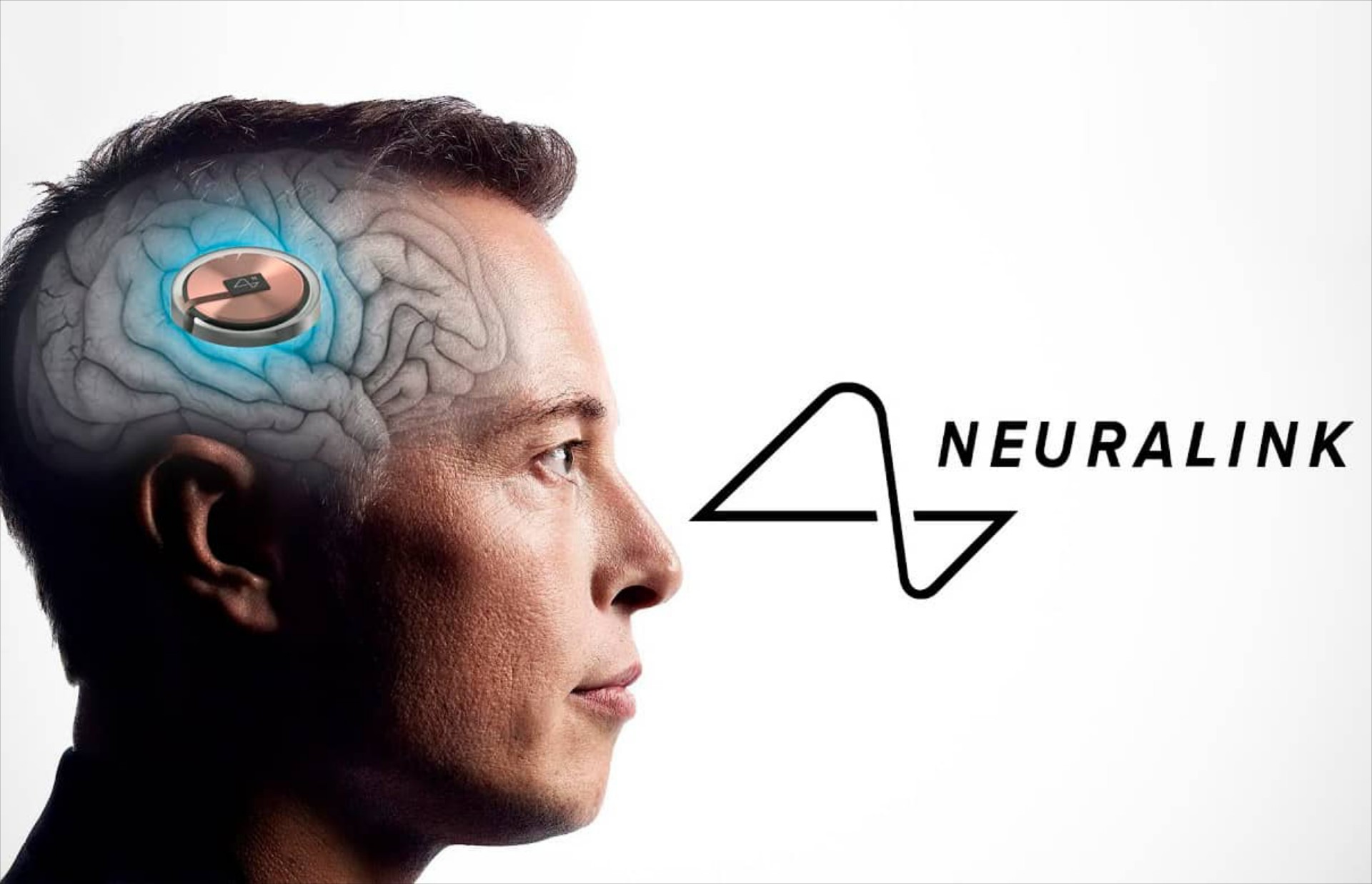 Τσιπάκι σε ανθρώπινο εγκέφαλο: Η Neuralink του Elon Musk ψάχνει εθελοντή