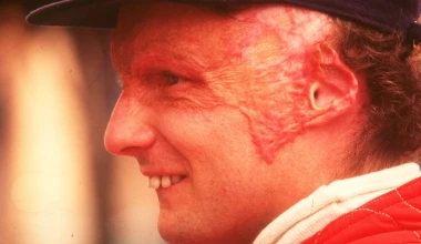 Niki Lauda: «Υπερποντικός» με προσωπικότητα